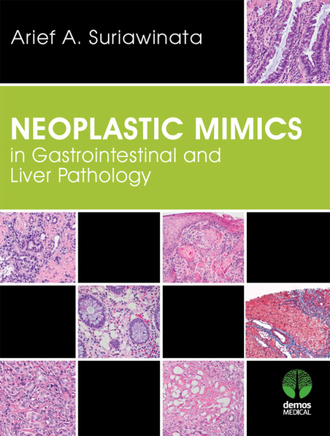 Cover image for book Neoplastic Mimics in Gastrointestinal and Liver Pathology