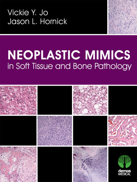 Cover image for book Neoplastic Mimics in Soft Tissue and Bone Pathology