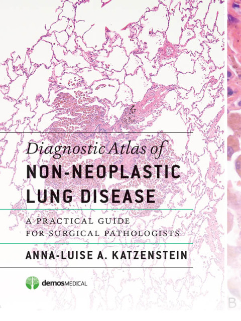 Cover image for book Diagnostic Atlas of Non-Neoplastic Lung Disease