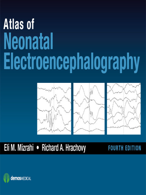 Cover image for book Atlas of Neonatal Electroencephalography, Fourth Edition