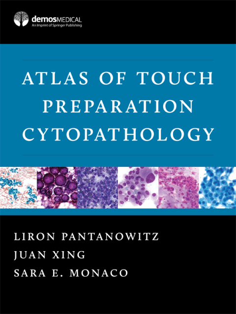 Cover image for book Atlas of Touch Preparation Cytopathology