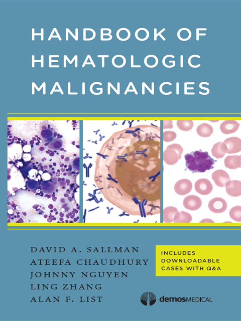 Cover image for book Handbook of Hematologic Malignancies
