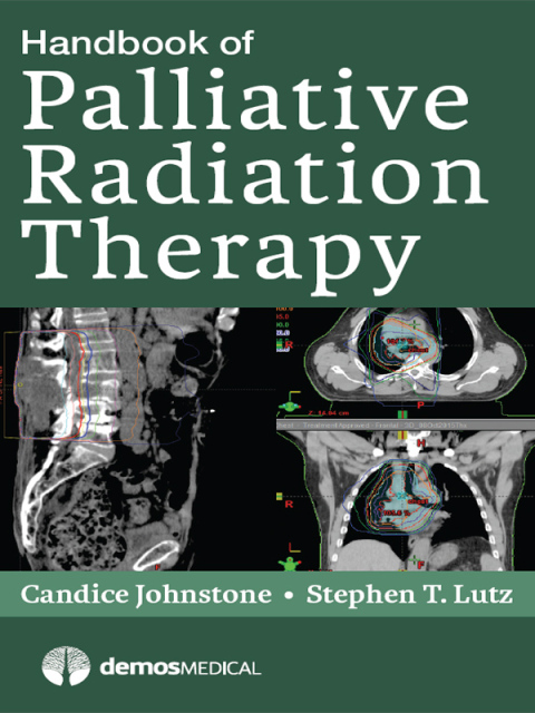 Cover image for book Handbook of Palliative Radiation Therapy