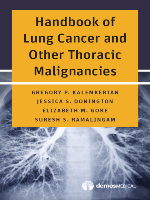 Cover image for book Handbook of Lung Cancer and Other Thoracic Malignancies