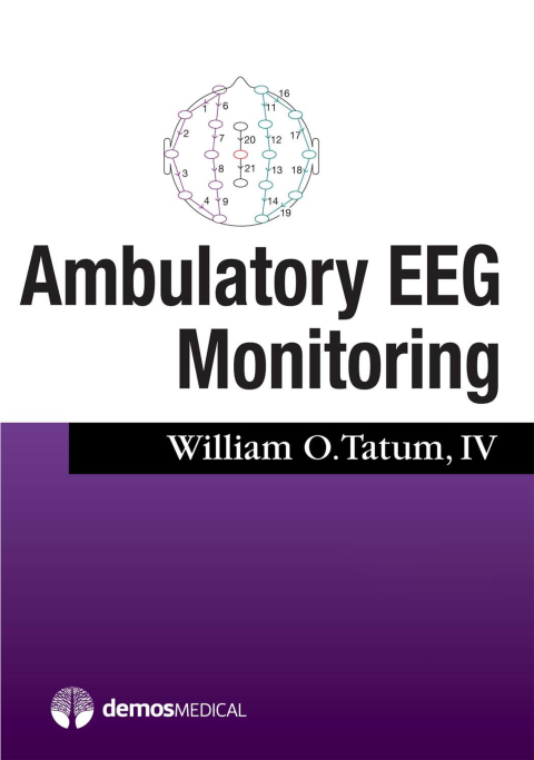 Ambulatory EEG Monitoring 