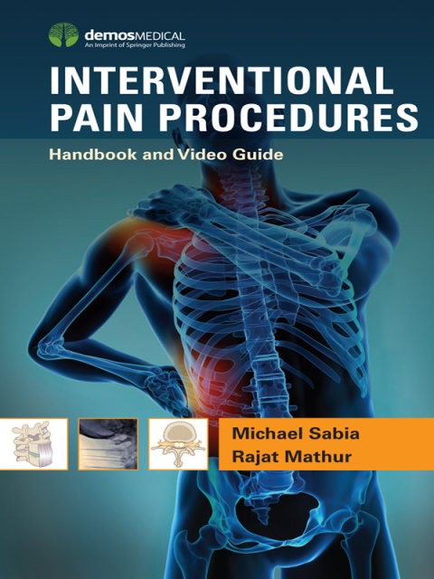 Cover image for book Interventional Pain Procedures