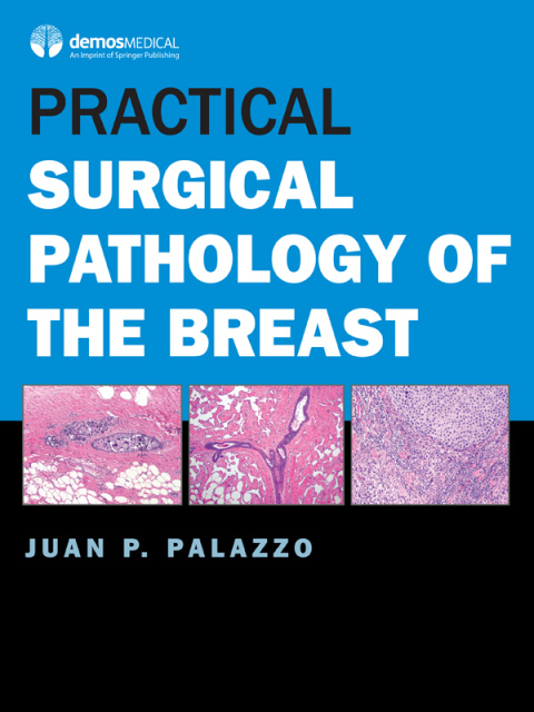 Cover image for book Practical Surgical Pathology of the Breast