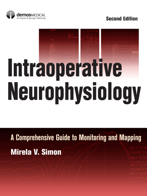 Cover image for book Intraoperative Neurophysiology