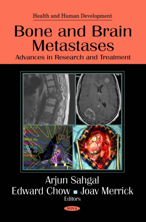 Cover image for book Bone and Brain Metastases: Advances in Research and Treatment