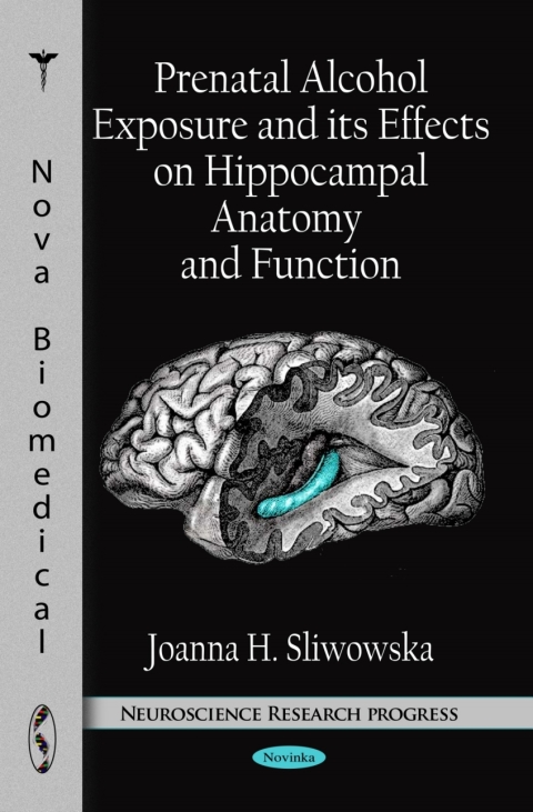 Cover image for book Prenatal Alcohol Exposure and its Effects on Hippocampal Anatomy and Function