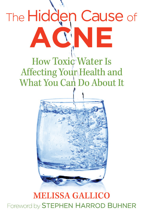 Cover image for book The Hidden Cause of Acne