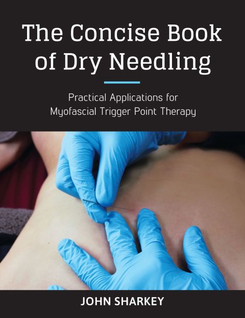 Cover image for book The Concise Book of Dry Needling