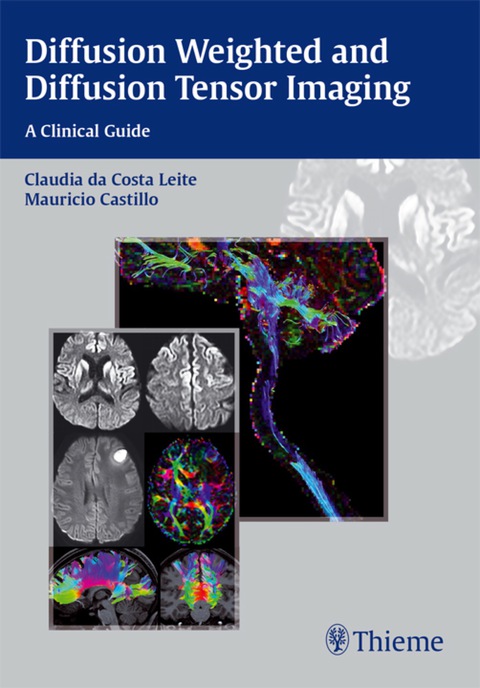 Cover image for book Diffusion Weighted and Diffusion Tensor Imaging