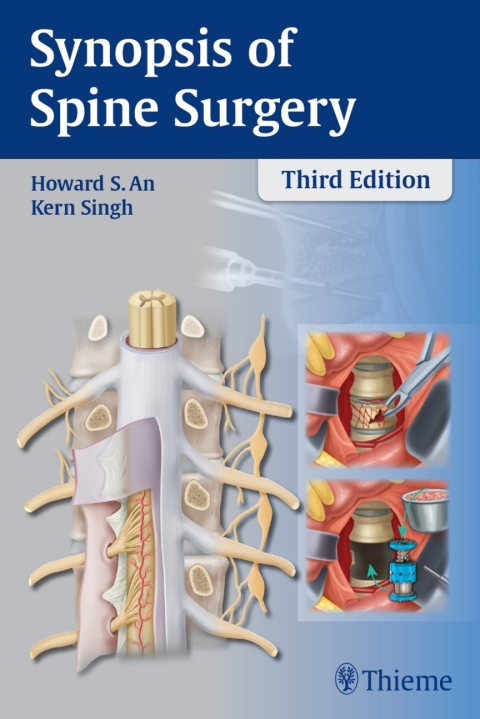 Synopsis of Spine Surgery 