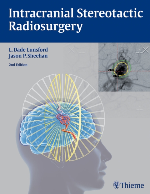 Cover image for book Intracranial Stereotactic Radiosurgery