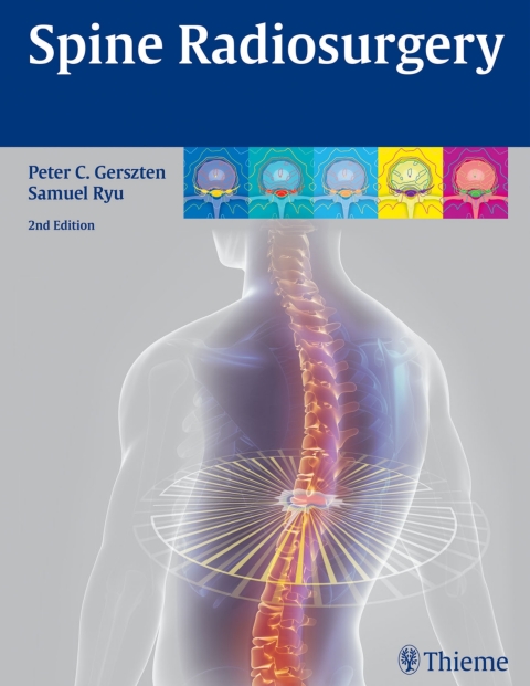 Cover image for book Spine Radiosurgery