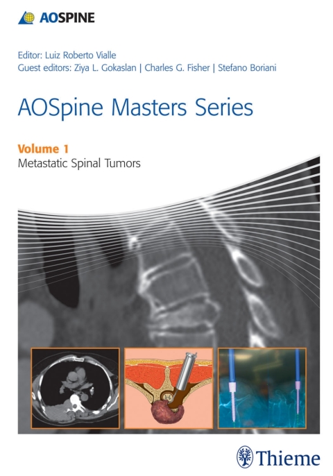 Cover image for book AOSpine Masters Series, Volume 1: Metastatic Spinal Tumors