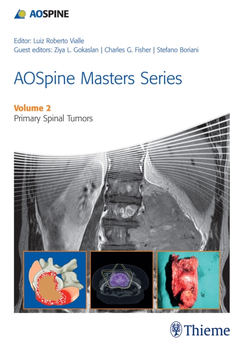 Cover image for book AOSpine Masters Series, Volume 2: Primary Spinal Tumors