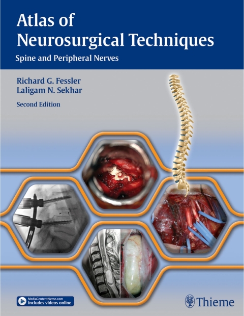 Cover image for book Atlas of Neurosurgical Techniques