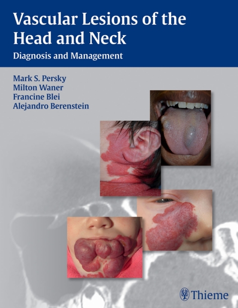 Cover image for book Vascular Lesions of the Head and Neck