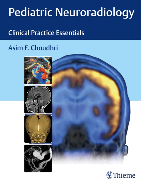 Cover image for book Pediatric Neuroradiology