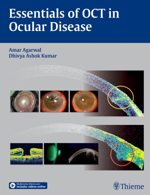 Essentials of OCT in Ocular Disease 