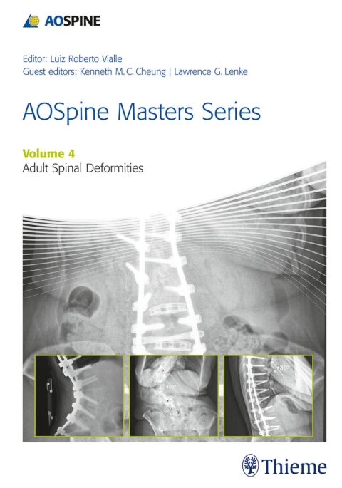 Cover image for book AOSpine Masters Series, Volume 4: Adult Spinal Deformities