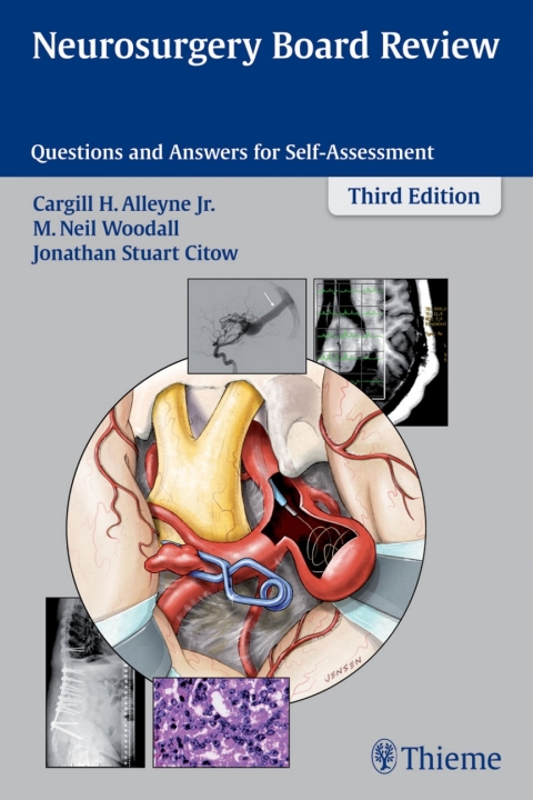 Neurosurgery Board Review 