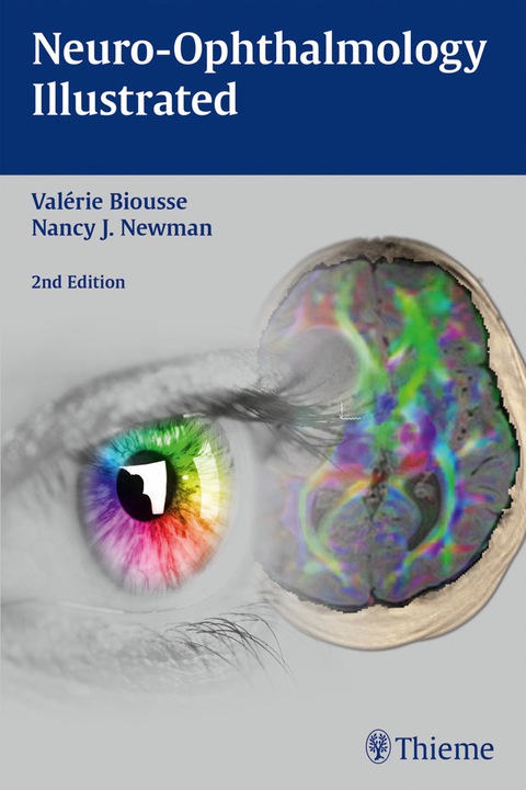 Cover image for book Neuro-Ophthalmology Illustrated