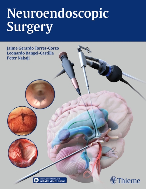 Cover image for book Neuroendoscopic Surgery
