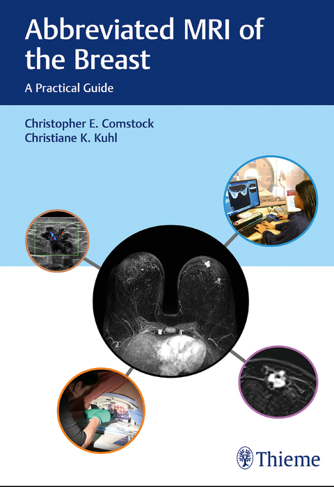 Cover image for book Abbreviated MRI of the Breast