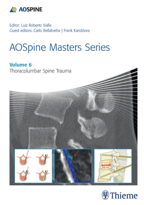 Cover image for book AOSpine Masters Series, Volume 6: Thoracolumbar Spine Trauma