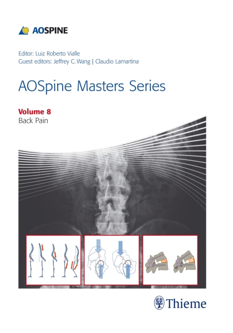 Cover image for book AOSpine Masters Series, Volume 8: Back Pain