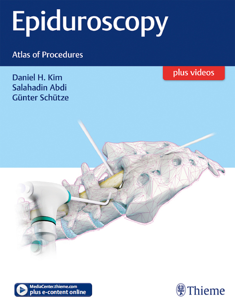 Cover image for book Epiduroscopy