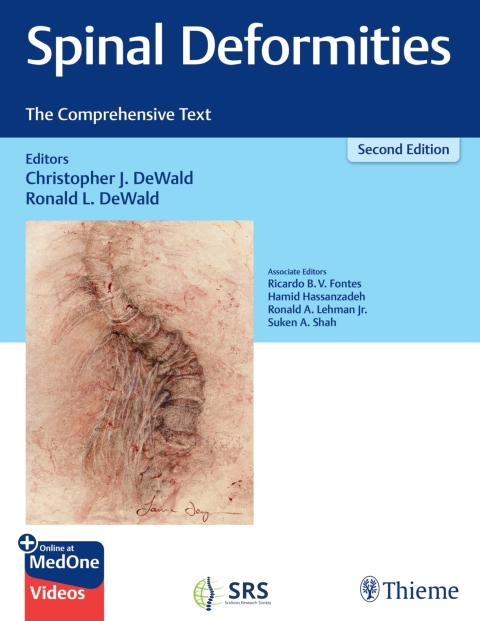 Spinal Deformities 