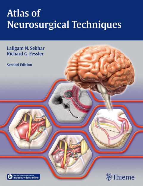 Cover image for book Atlas of Neurosurgical Techniques