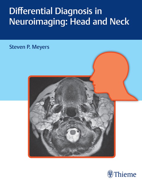 Differential Diagnosis in Neuroimaging: Head and Neck 