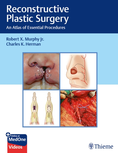 Cover image for book Reconstructive Plastic Surgery