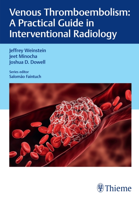 Cover image for book Venous Thromboembolism