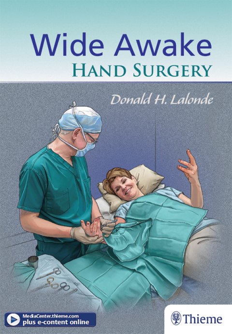 Cover image for book Wide Awake Hand Surgery