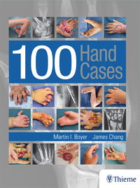 صورة الغلاف: 100 Hand Cases 1st edition 9781626237582