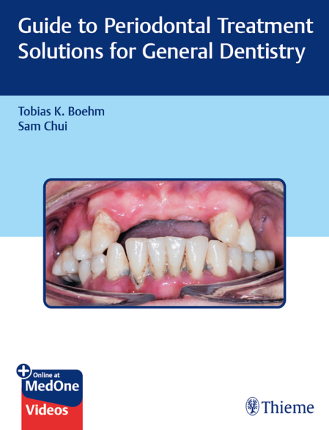 Guide to Periodontal Treatment Solutions for General Dentistry 