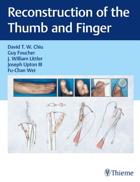 Cover image for book Reconstruction of the Thumb and Finger