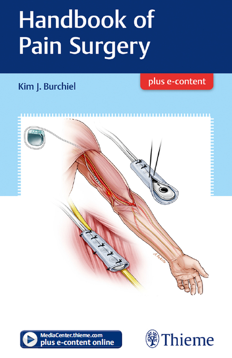 Cover image for book Handbook of Pain Surgery