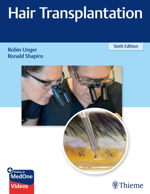 Cover image for book Hair Transplantation