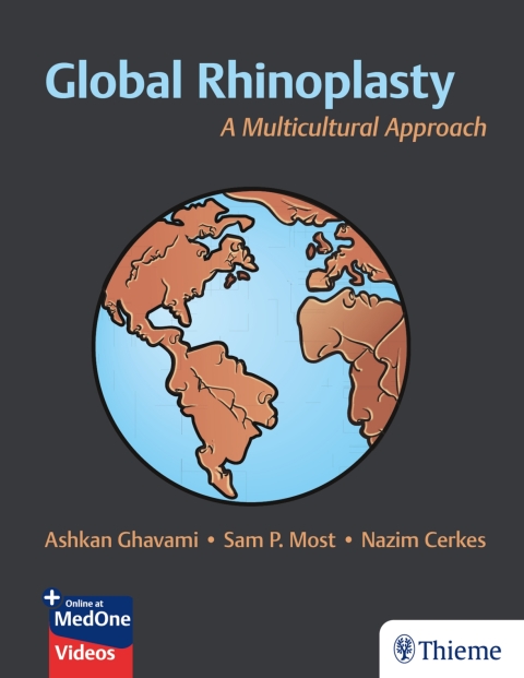 Cover image for book Global Rhinoplasty
