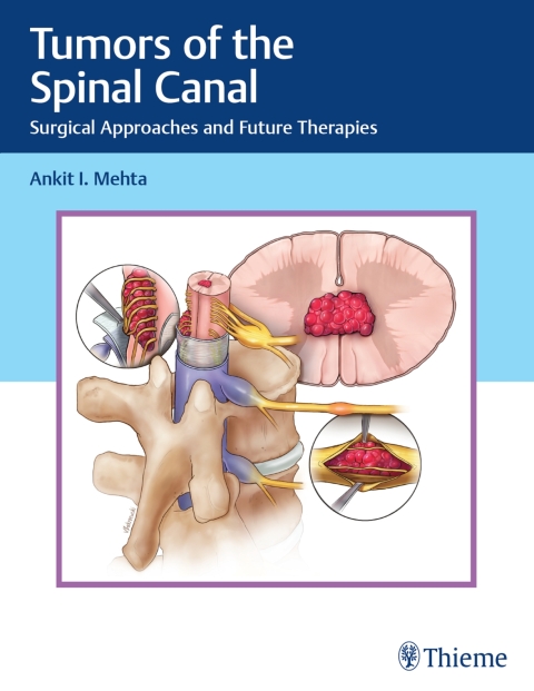 Cover image for book Tumors of the Spinal Canal