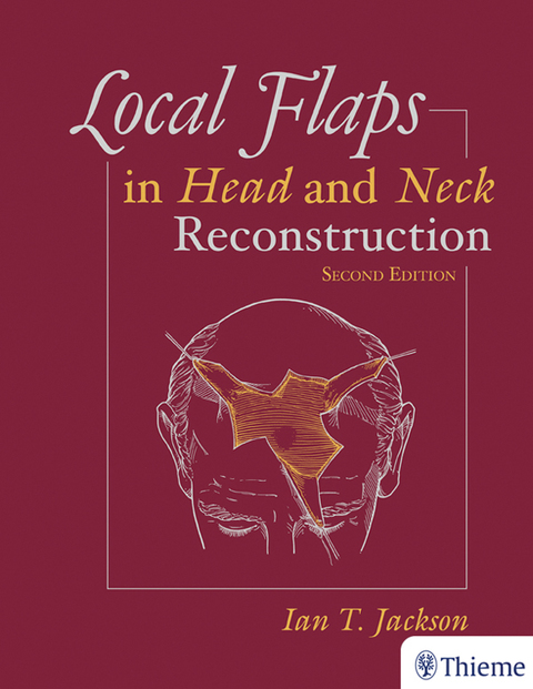 Local Flaps in Head and Neck Reconstruction 