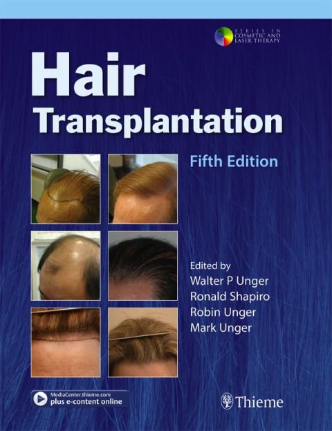 Cover image for book Hair Transplantation