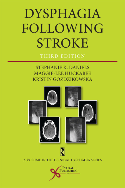 Cover image for book Dysphagia Following Stroke